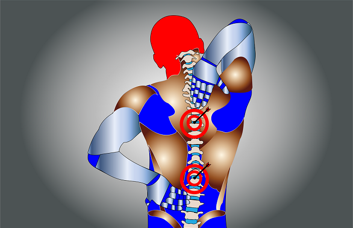 back-pain-spine-5318474_1280.png